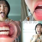 【個人撮影】加護まりの舌ブラシで「汚舌苔」採取